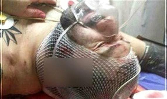 آخرین وضعیت جسمی «هانی کُرده» از زبان پلیس