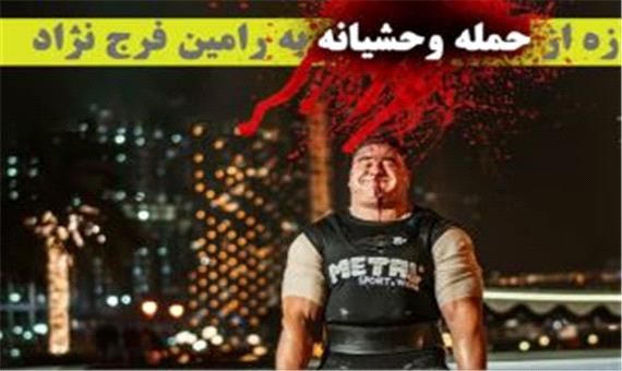 قهرمان قویترین مردان ایران گلوله خورد