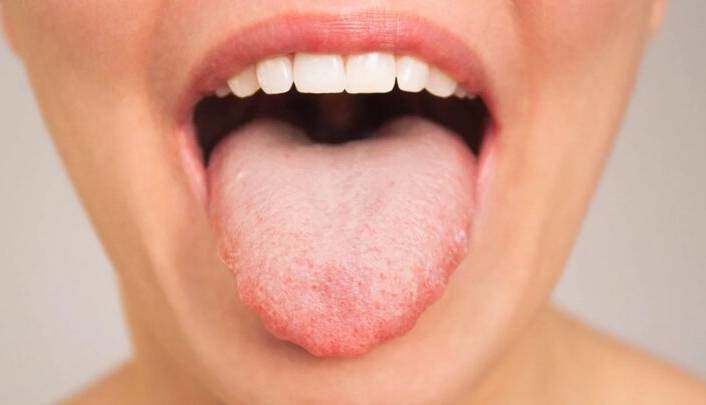 ارتباط عجیب باکتری‌های دهان با سرعت تفکر ما